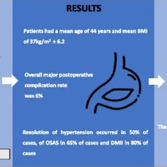 Gastric Clip Surgery - Permanently and safe weight loss