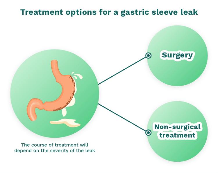 Gastric Clip Surgery - Permanently and safe weight loss